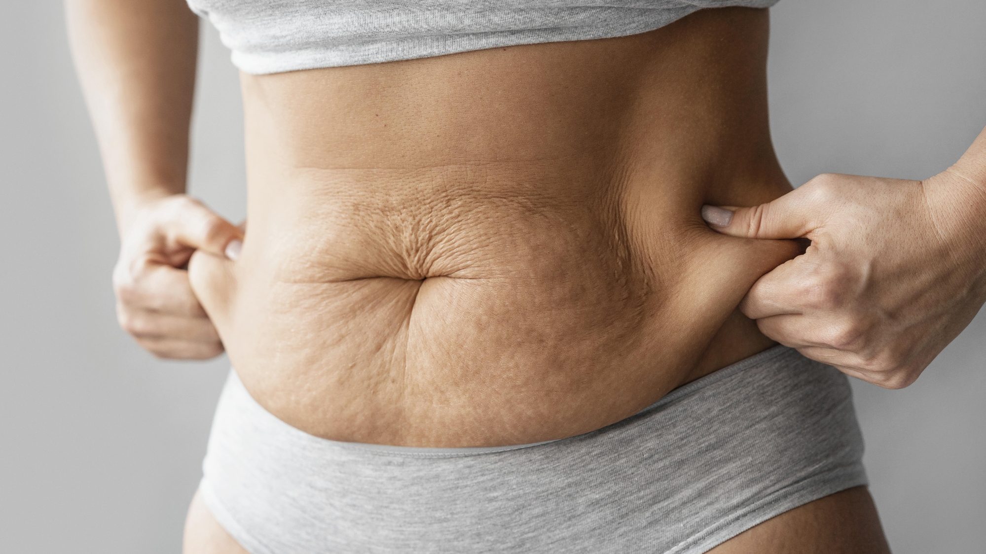 close-up-hands-holding-body-fat1765355800691893382